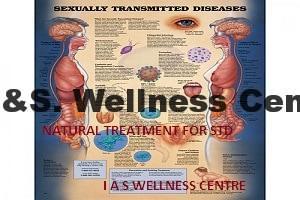sexually transmitted disease (Std)