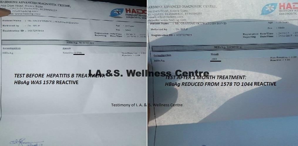 Hepatitis B .Test b4 & After treatment I.A.S Wellness Centre