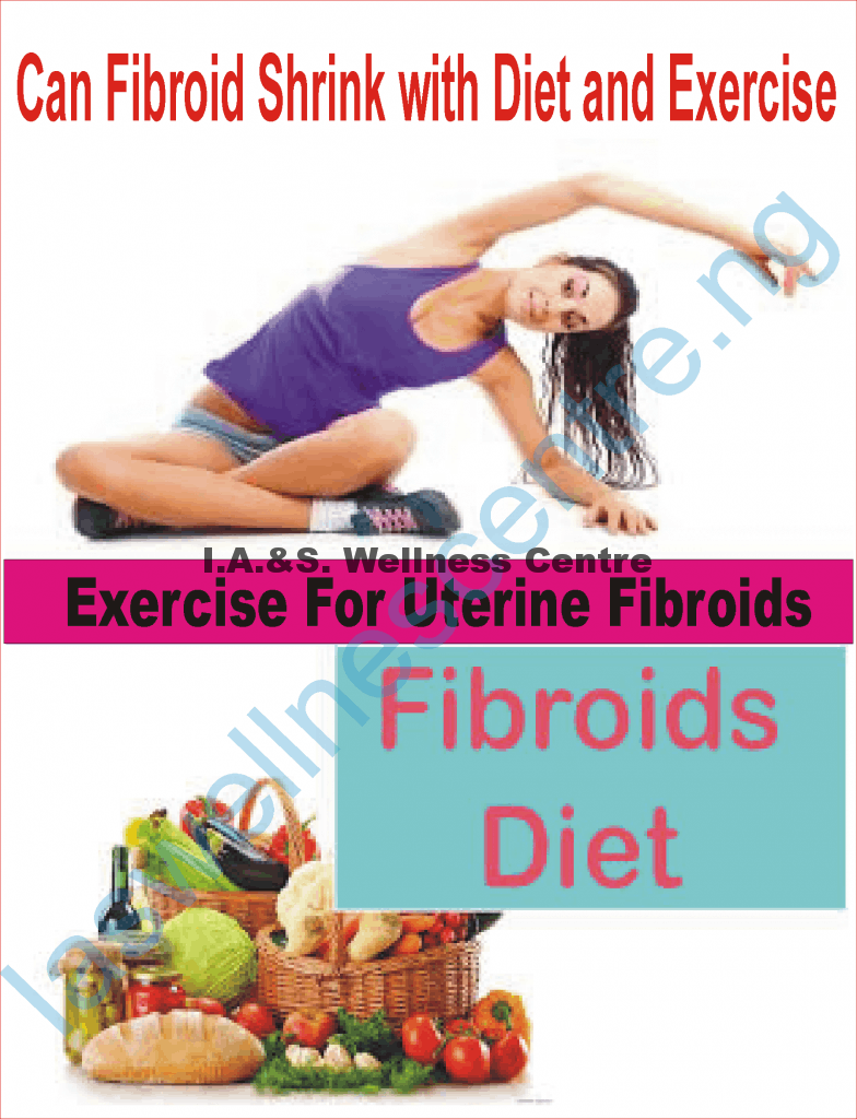 CAN FIBROIDS SHRINK WITH DIET AND EXERCISE?