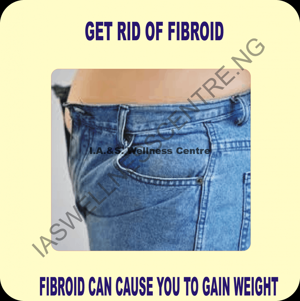 CAN FIBROID CAUSE YOU TO GAIN WEIGHT