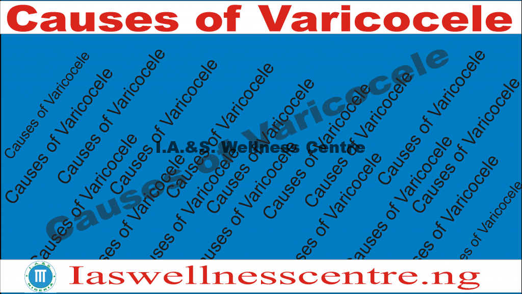CAUSES OF VARICOCELE AND IT’S NATURAL TREATMENT IN NIGERIA