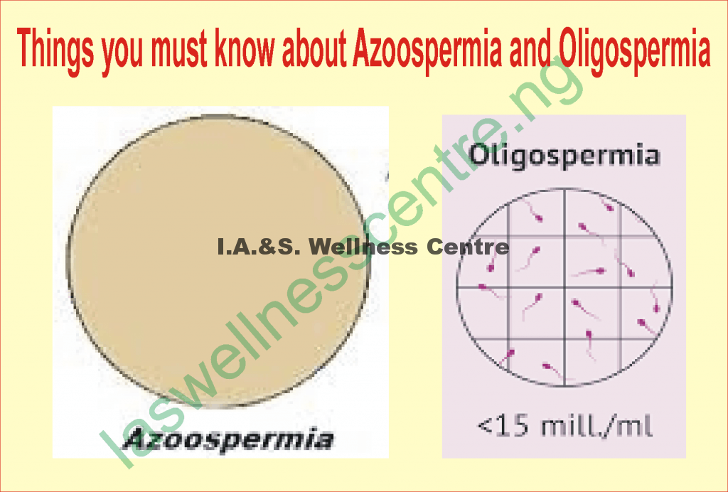 DIFFERENCE BETWEEN OLIGOSPERMIA AND AZOOSPERMIA AND IT’S NATURAL TREATMENT IN NIGERIA