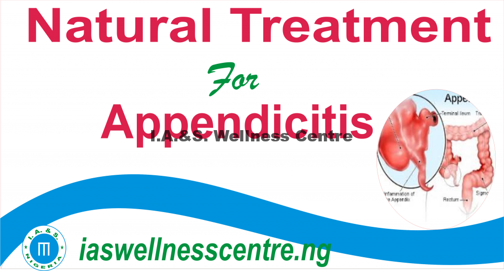 APPENDICITIS AND IT’S NATURAL TREATMENT IN NIGERIA