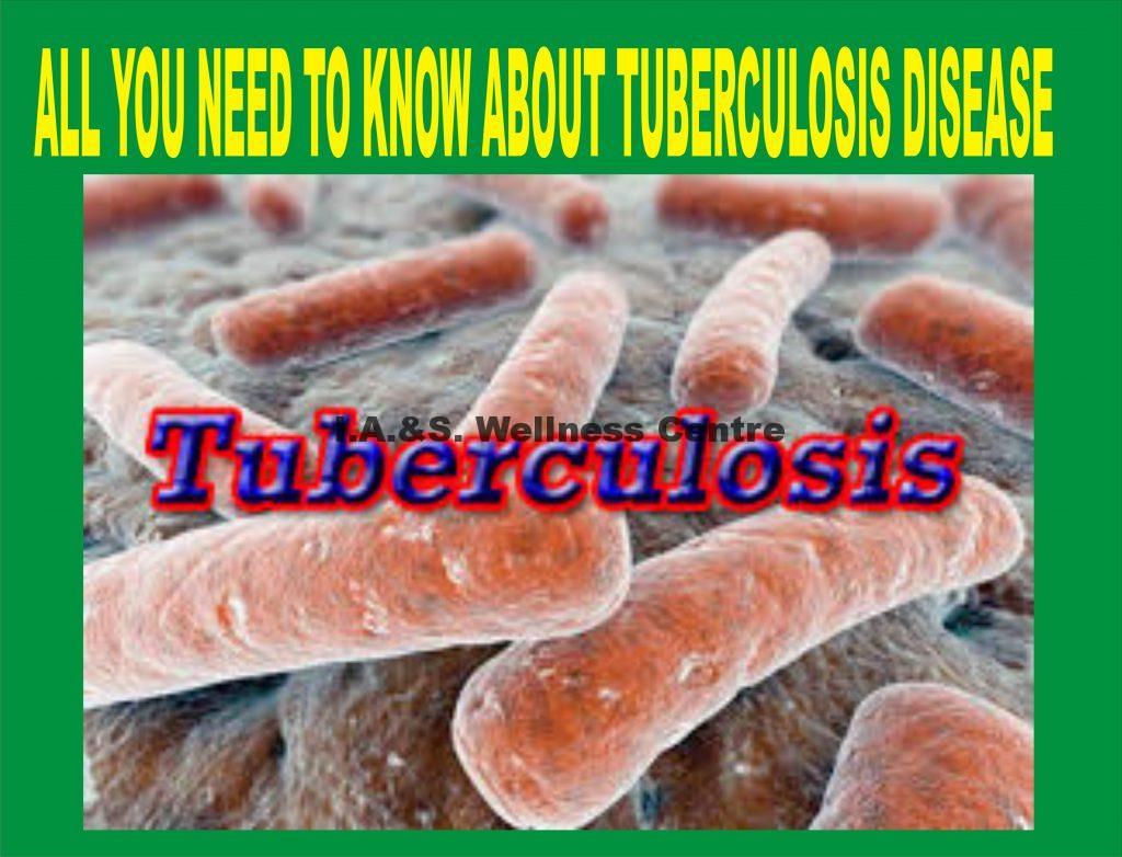 All You Need To Know About Tuberculosis Disease And It’s Natural Treatment In Nigeria