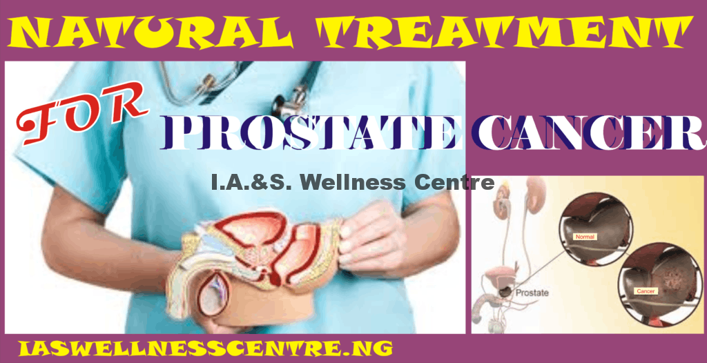 NATURAL TREATMENT FOR PROSTATE CANCER IN NIGERIA