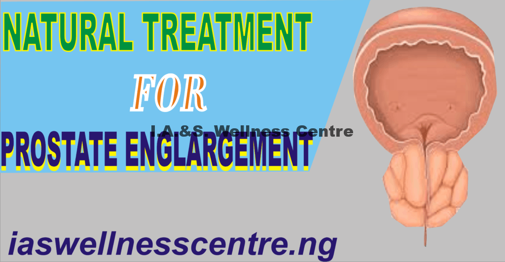 NATURAL TREATMENT FOR PROSTATE ENLARGEMENT IN NIGERIA