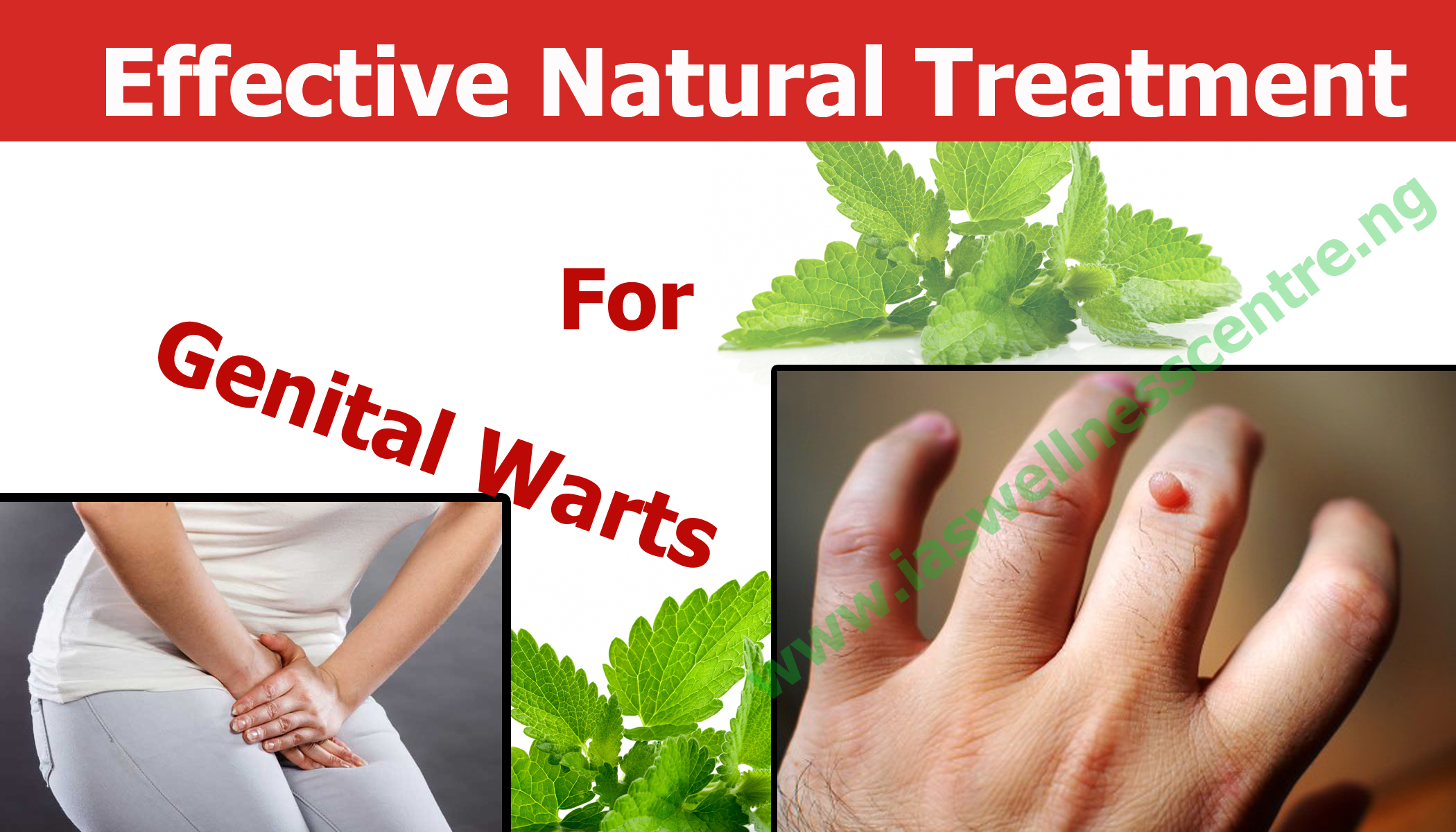 Warts for hpv natural treatment Natural Remedies