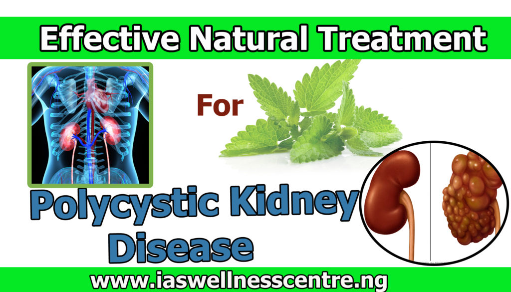 effective natural treatment for Polycystic Kidney Disease
