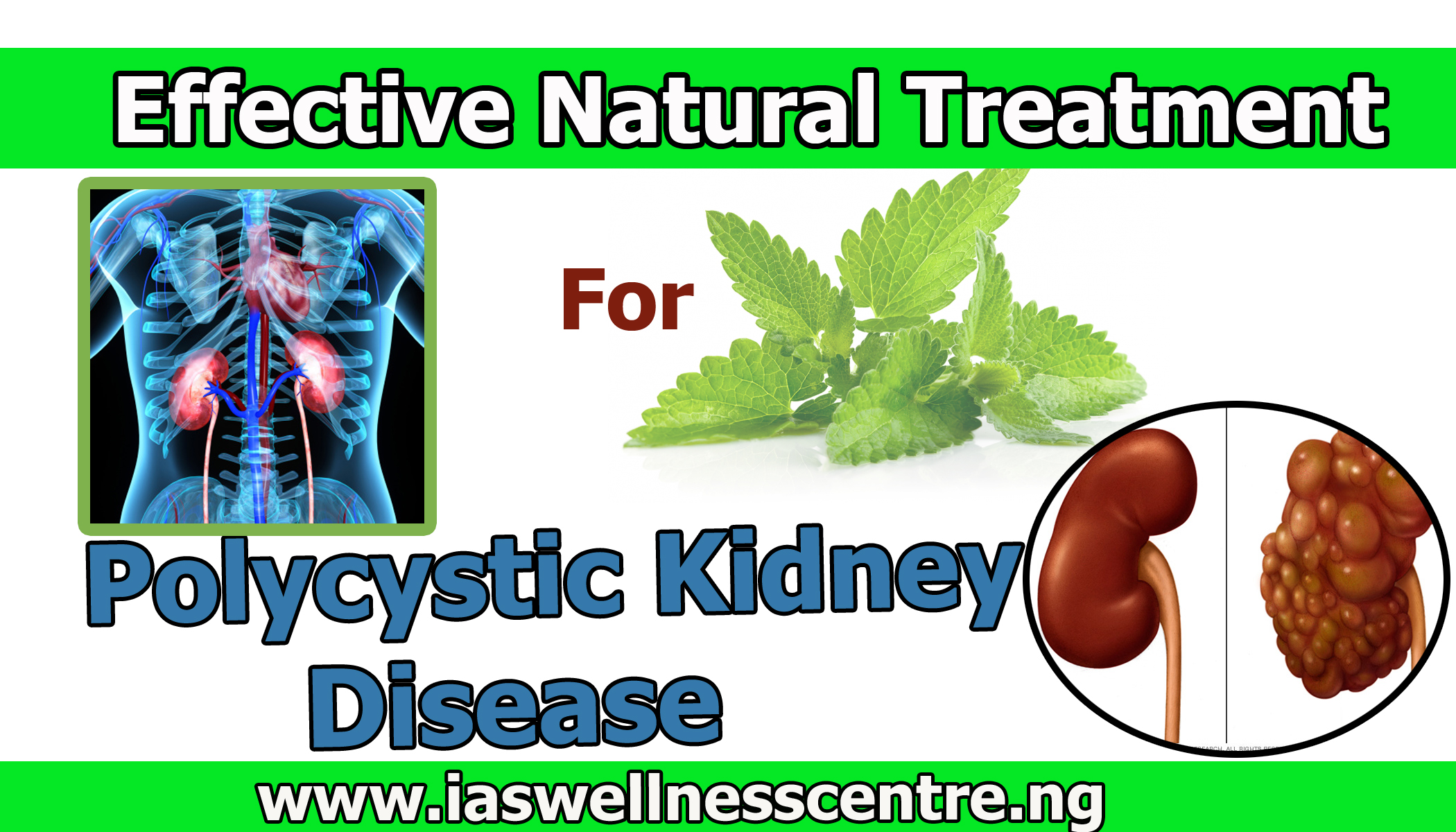 effective-natural-treatment-for-polycystic-kidney-disease-pkd-in