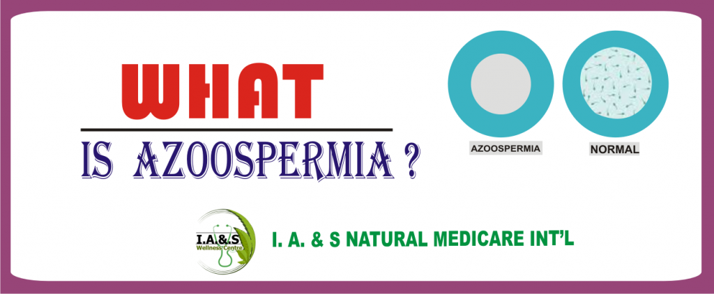 WHAT IS AZOOSPERMIA?