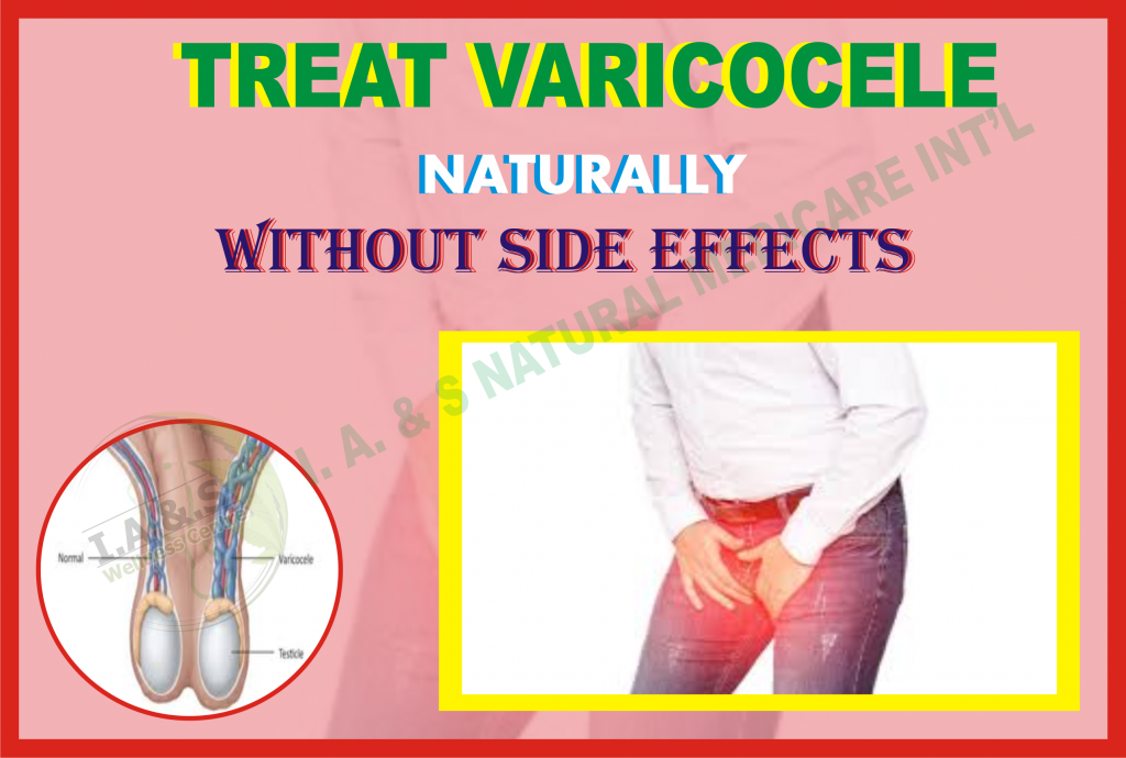 TREAT VARICOCELE NATURALLY WITHOUT SIDE EFFECTS