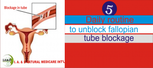 5 EFFECTIVE DAILY ROUTINE TO UNBLOCK FALLOPIAN TUBE OBSTRUCTION