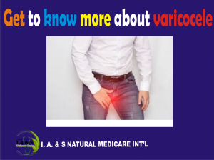 GET TO KNOW MORE ABOUT VARICOCELE